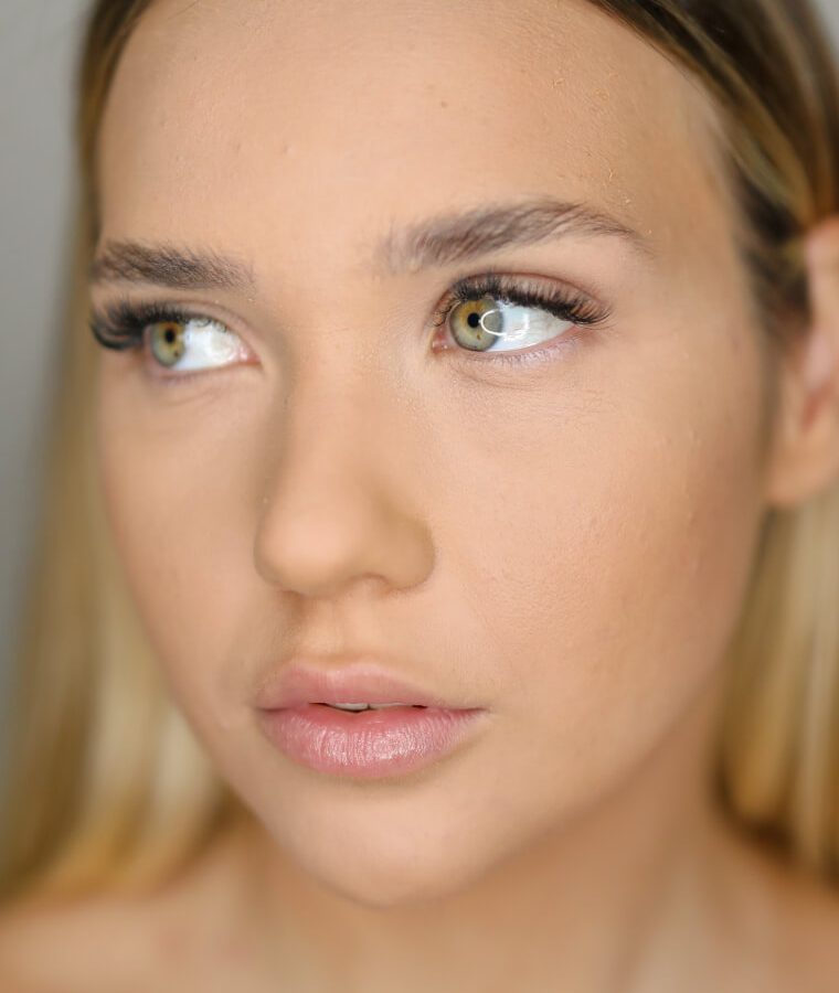FILLER PERIOCULARE donna