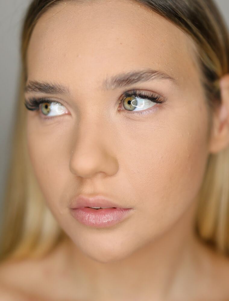FILLER PERIOCULARE donna