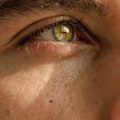 FILLER PERIOCULARE uomo