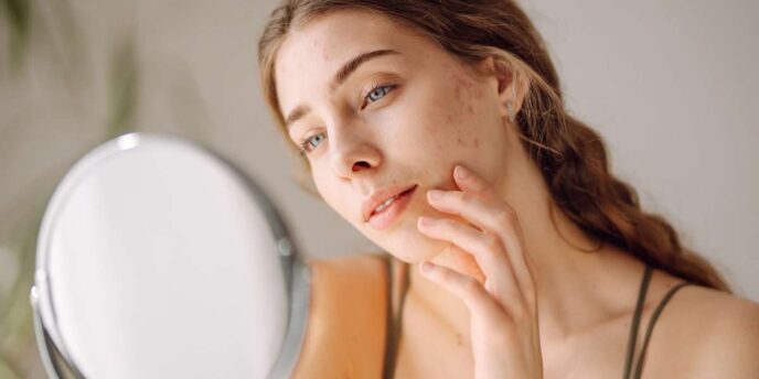 cicatrici-da-acne-laser
