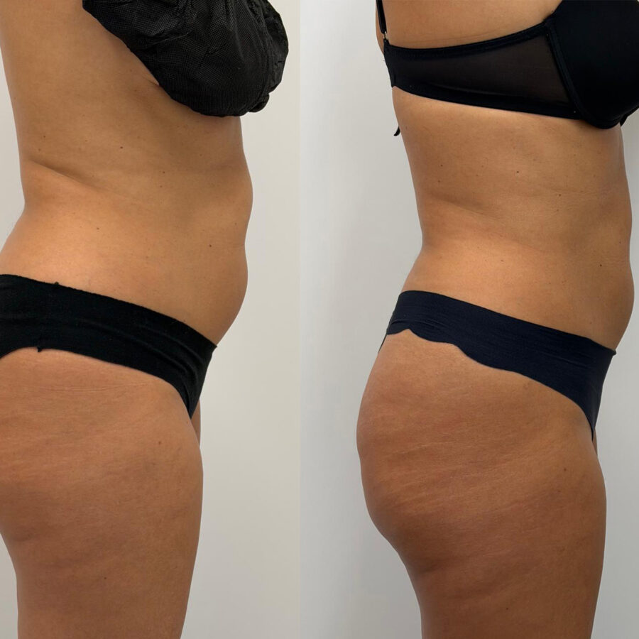 Crio caso 15 Pre e post dx